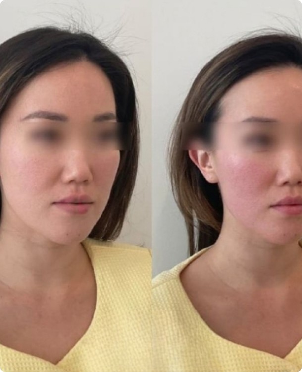 Фото результата #2